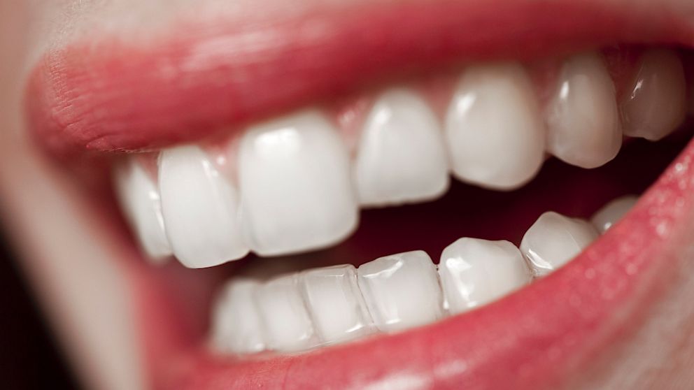 Human teeth